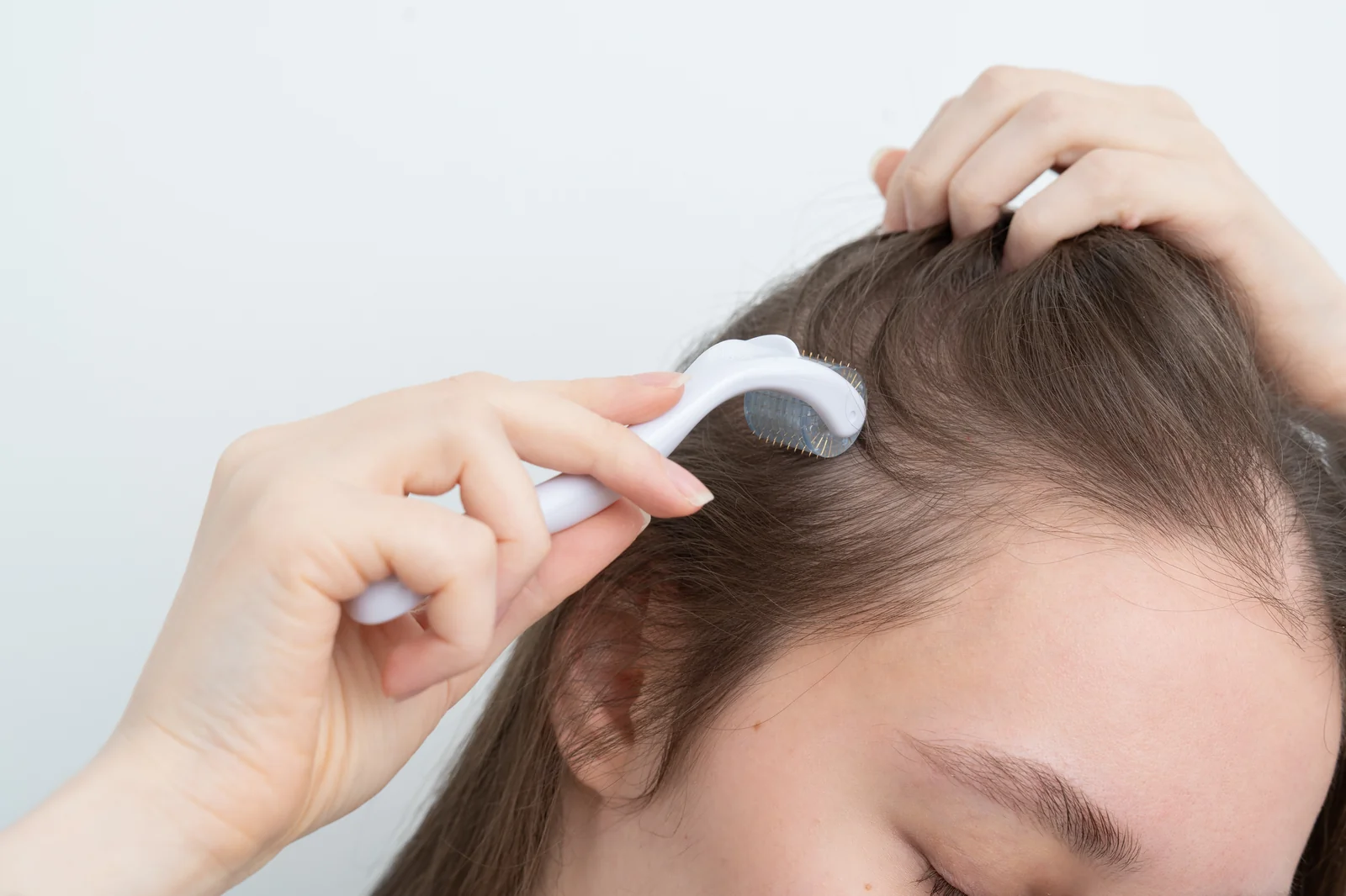 Hair-loss-in-Beachwood-OH.webp